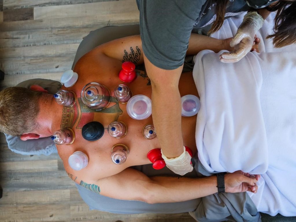 What Does A Cupping Massage Actually Feel Like Accucare